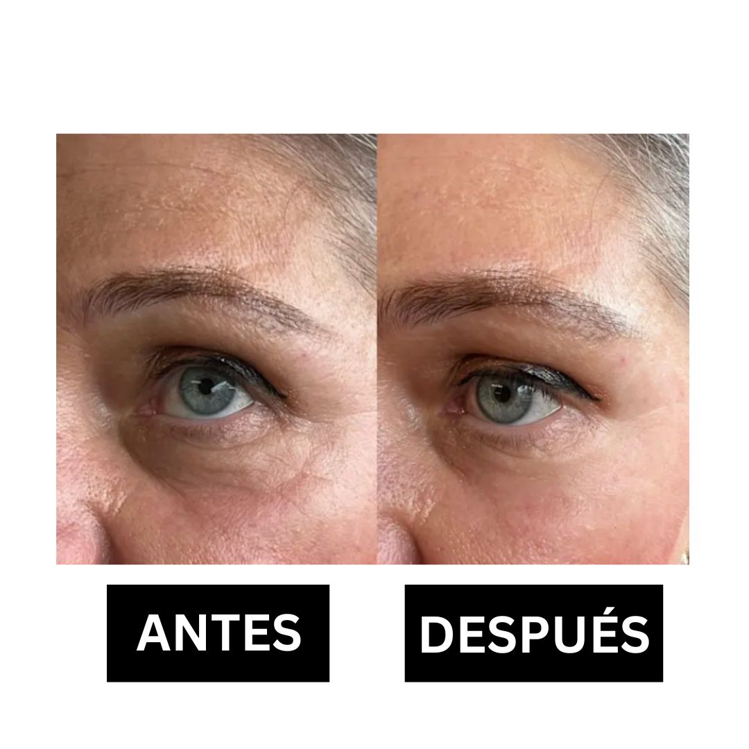2 unidades Crema Antiarrugas