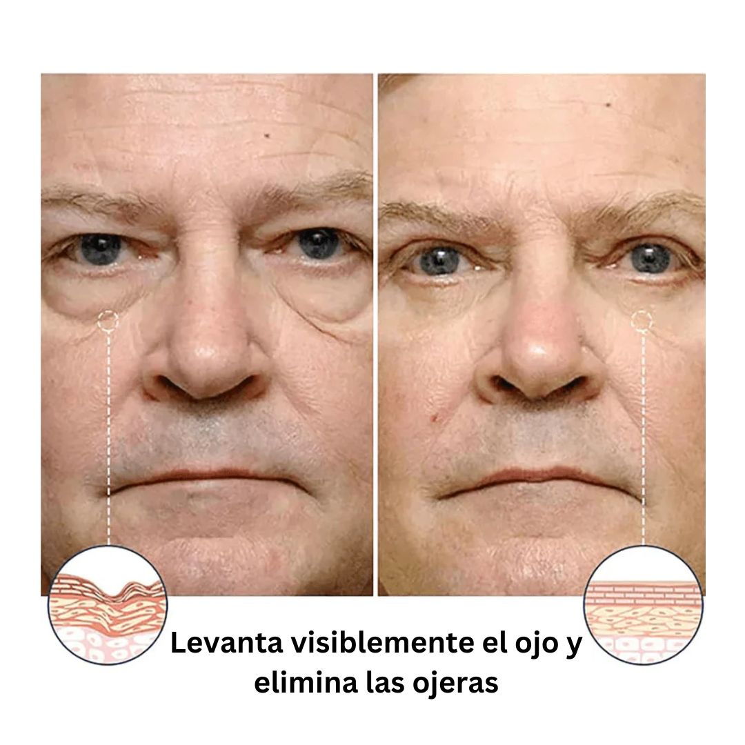 2 unidades Crema Antiarrugas