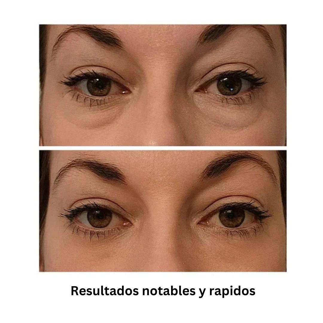 2 unidades Crema Antiarrugas