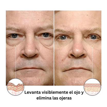 2 unidades Crema Antiarrugas